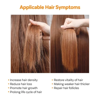 2022 prírodné vlasové produkty pre starostlivosť o prírodné anti alopécia prevencie alopécia liečba rýchly rast výživy suché, poškodené vlasy starostlivosť